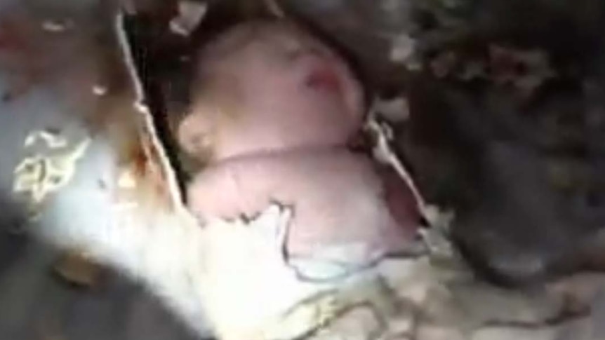 Hospital workers and fire fighters free a newborn baby from sewer pipes
