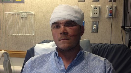 Chase Dellwo, who survived a grizzly bear attack