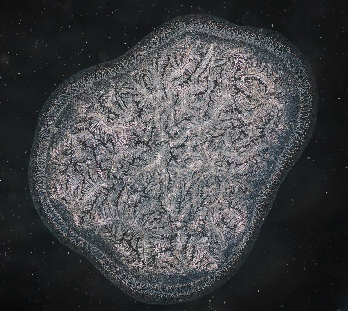 Human Tears Under a Microscope Look Like Aerial Views of Earth Things under a mi