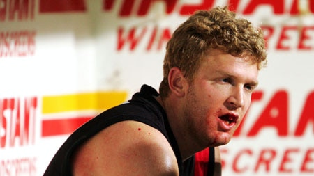 Dustin Fletcher of Essendon after having teeth knocked out