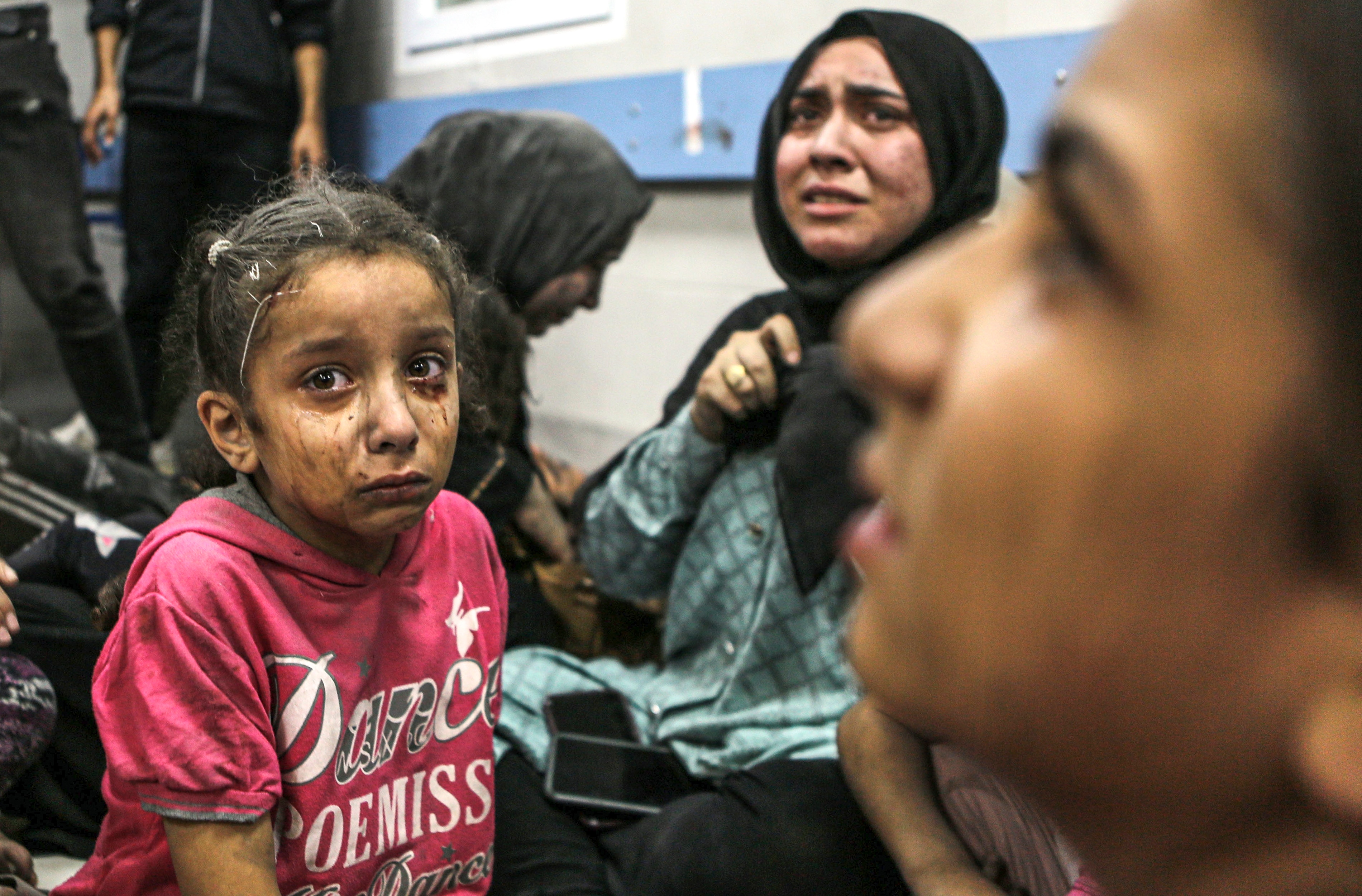 Young girl with tear and soot stained face looks at camera 