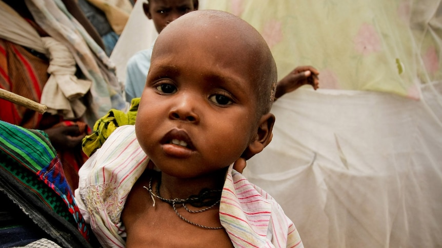 A woman holds a severely malnourished child in a refugee camp in Mogadishu, Somalia.