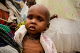 A woman holds a severely malnourished child in a refugee camp in Mogadishu, Somalia.