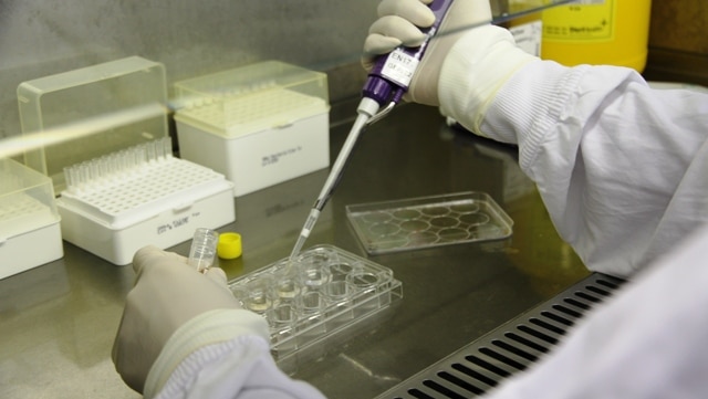 Newcastle researchers hoping a new discovery will help in the treatment of STIs in women.