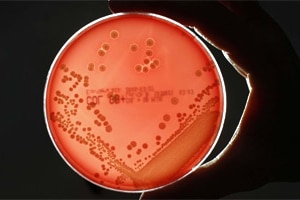 A hand holds a petri dish containing a naturally created bacteria (Fabrizio Bensch/Reuters)