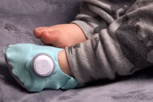 A baby's foot wearing the Owlet Smart Sock.