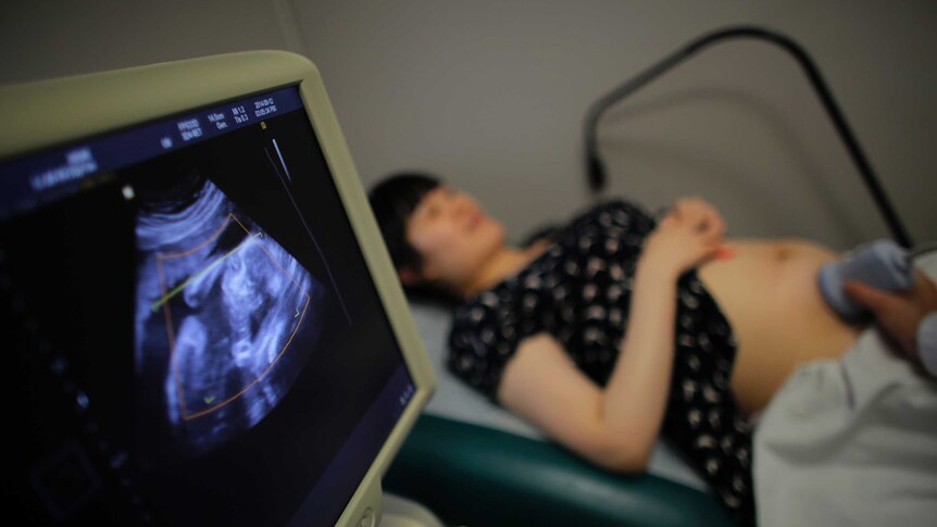 A woman lies down for a sonogram at a local hospital.