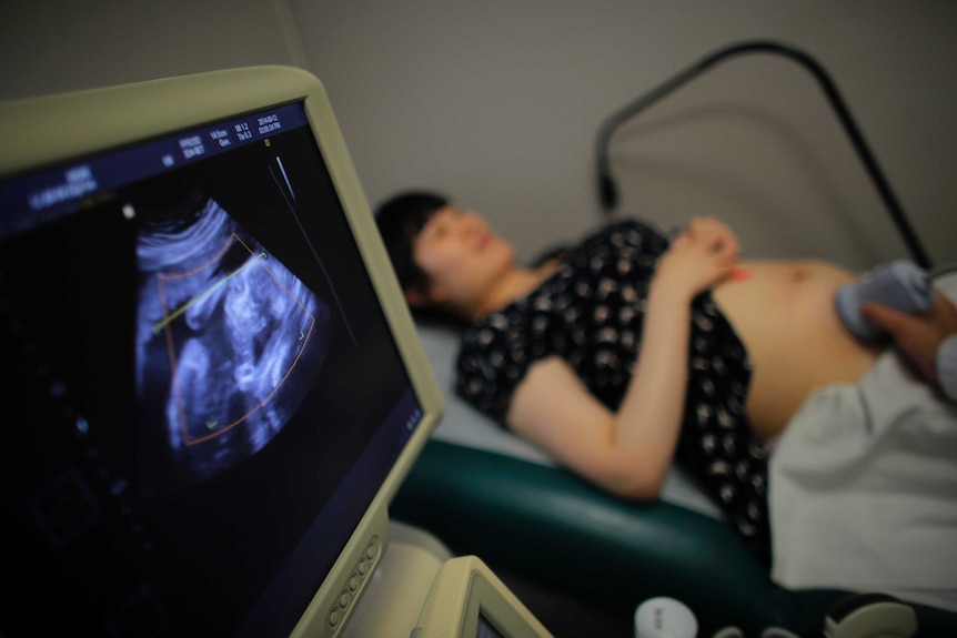 A woman lies down for a sonogram at a local hospital.