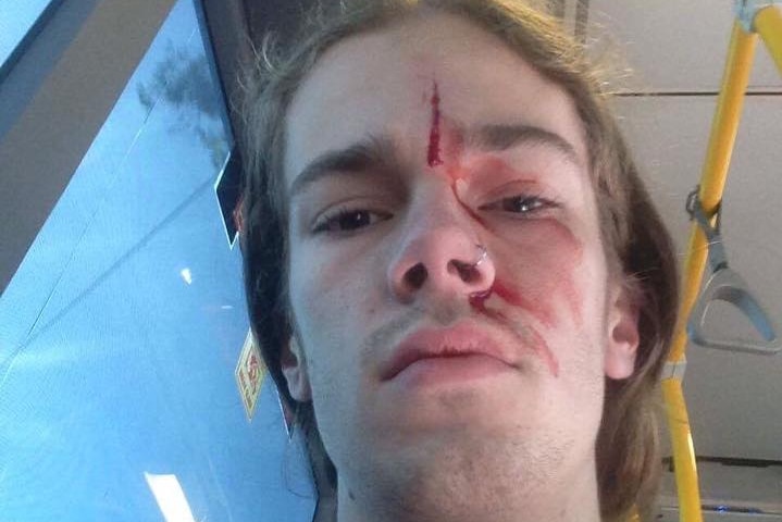 Kevin Rudd's godson Sean with blood on his face