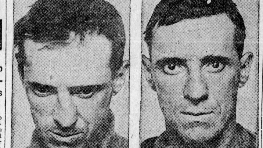 B&W newspaper photo of two men before and after plastic surgery - one with nose straightened and one with ears pinned back