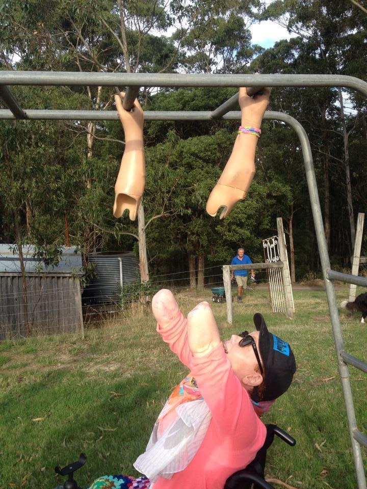 A fnphoto of a woman with amputed arms reaching up for her prostethic arms, which are holding onto monkey bars.
