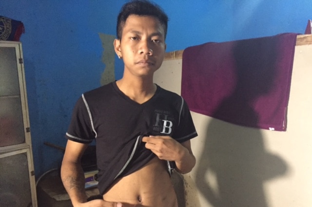 Kidney: 24-year-old Dasep