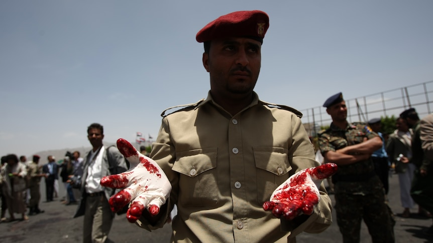 Scores killed in Yemen bomb