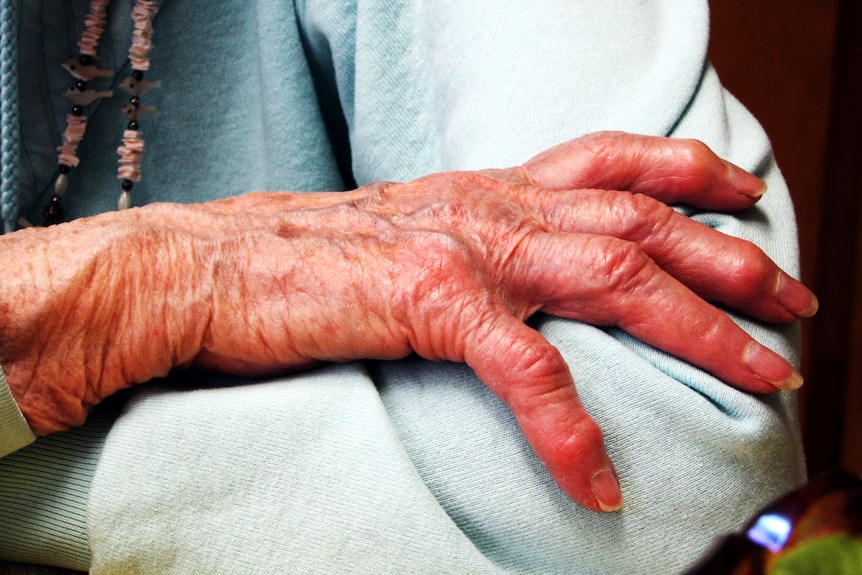 A close-up shot of a 91-year-old woman's hand resting on her opposite elbow.