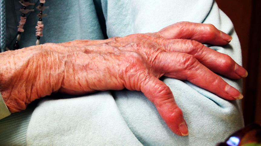 A close-up shot of a 91-year-old woman's hand resting on her opposite elbow.