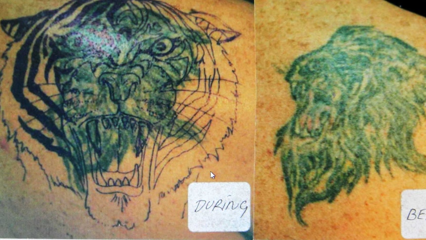 Tattoo cover up