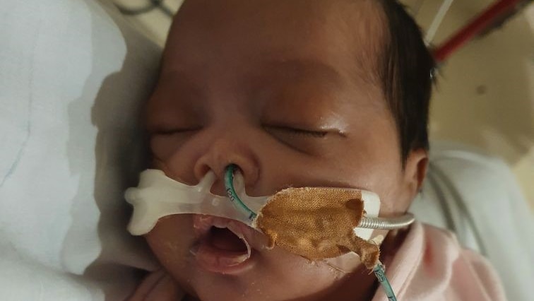 A baby with tubes in her nose.