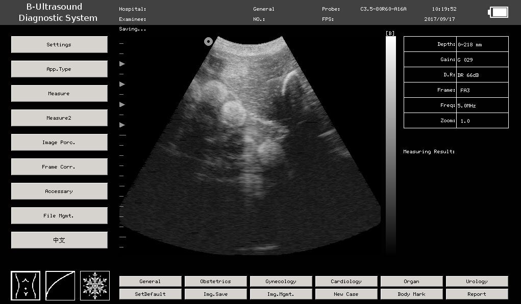 Researchers use ultrasound to learn more about Ningaloo's pregnant