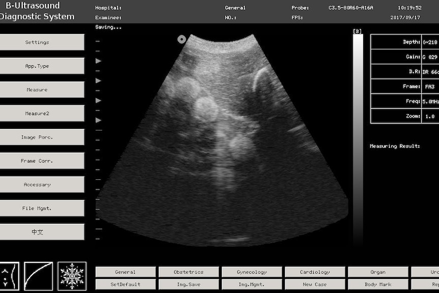 turtle egg ultrasound