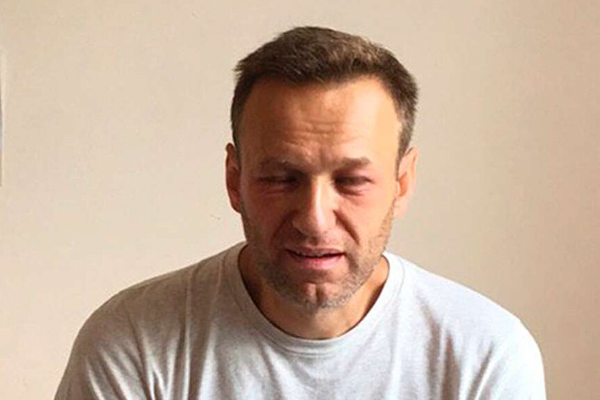 Alexei Navalny sits on a bed in a hospital in Moscow with facial swelling.