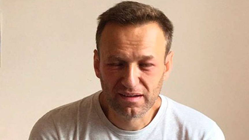 Alexei Navalny sits on a bed in a hospital in Moscow with facial swelling.