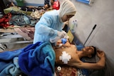 A medium photo of an injured man with a large bandage on his chest being treated by a woman in a crowded hospital.