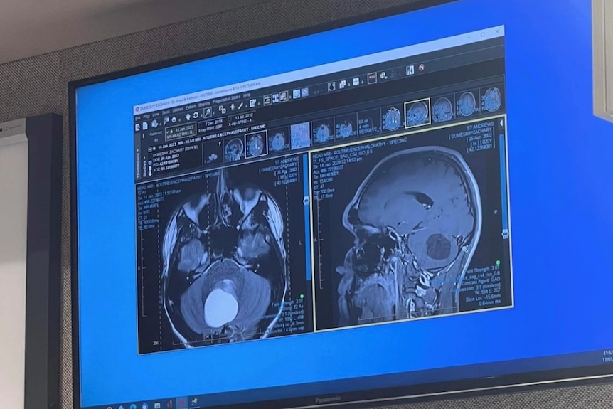 Medical imaging of a brain.
