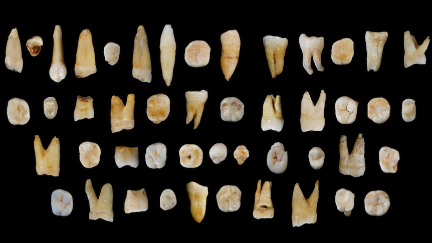Teeth from the oldest-known modern human in southern China