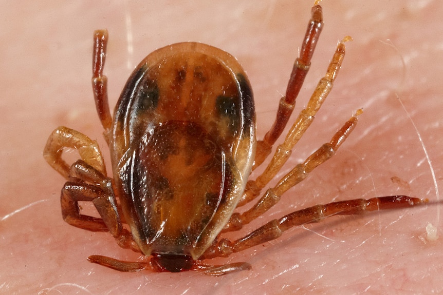 A female tick biting the skin of a human.