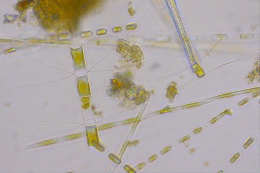 клетки под микроскоп 