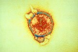 An artificially coloured electron micrograph of Hendra virus.