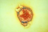 An artificially coloured electron micrograph of hendra virus.