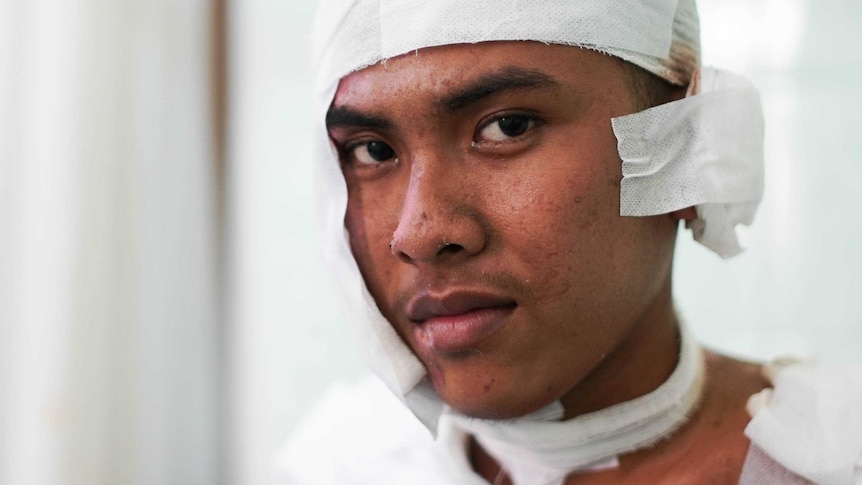 Anggi Aji Pangestu sits in hospital with his head wrapped in bandages