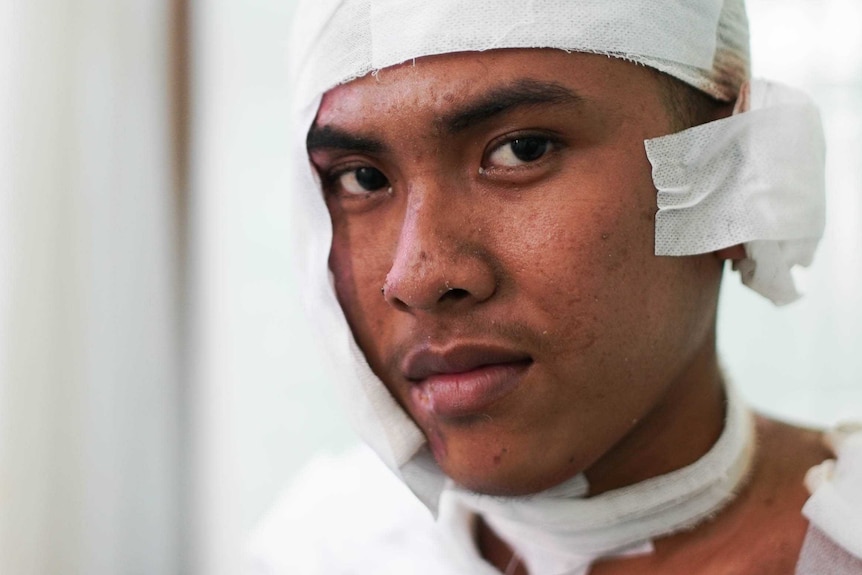 Anggi Aji Pangestu sits in hospital with his head wrapped in bandages