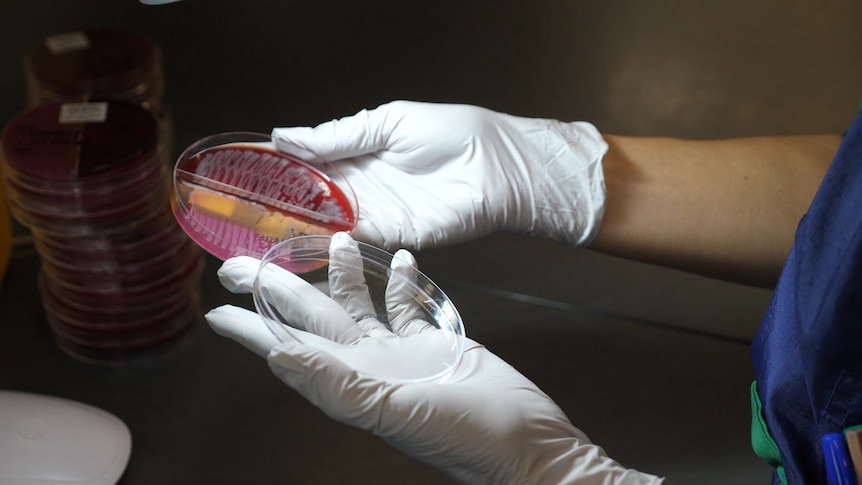 A person in scrubs and gloves holds a petri dish.