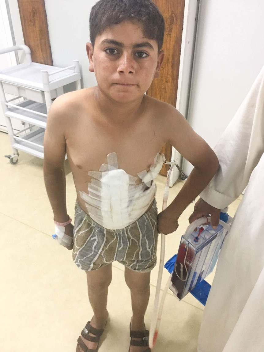 Boy shot in stomach