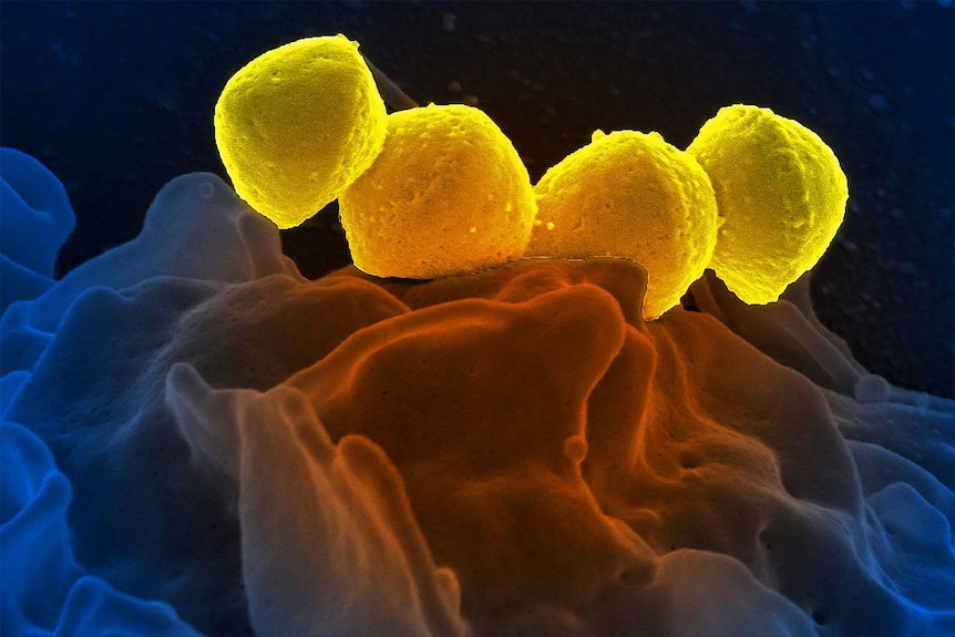 A digital image of a type of bacteria.