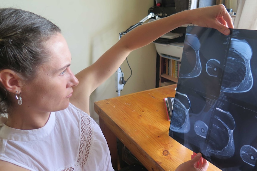 A woman inspects x-rays while sitting at a desk.