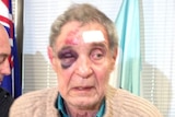 Nowra assault victim Francois Beugels