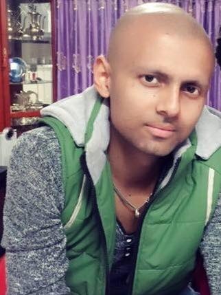 Ujwal Poudel has a bald head after losing his hair through cancer treatment 