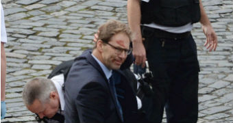 British MP Tobias Ellwood with blood smeared on his forehead.