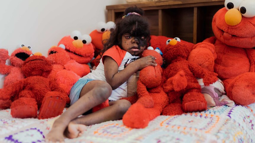 Symmie lies back holding an elmo doll, she is surrounded by about 10 of them.