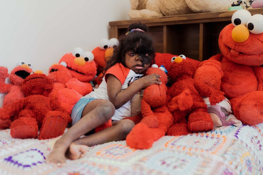 Symmie lies back holding an elmo doll, she is surrounded by about 10 of them.