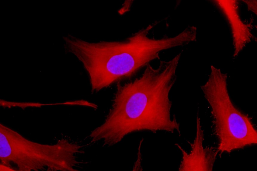 Mesenchymal stromal cells (stem cells) with fluorescent nucleus and cell proteins