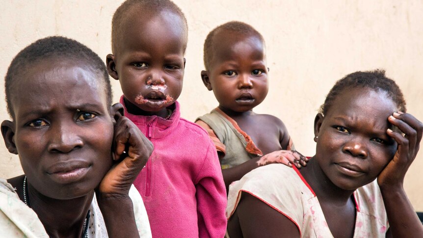 Two women and two children in South Sudan. One child has lesions on the corners of the mouth, which is a sign of malnutrition.