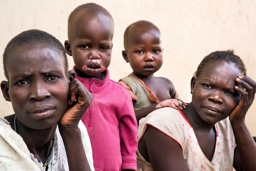 Two women and two children in South Sudan. One child has lesions on the corners of the mouth, which is a sign of malnutrition.