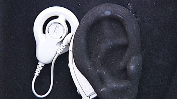 A cochlear implant