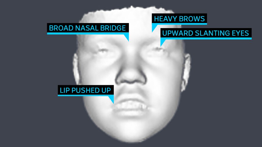 A graphic showing several facial features of someone with broad facial features.