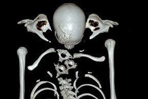 A digital render of a skeleton.