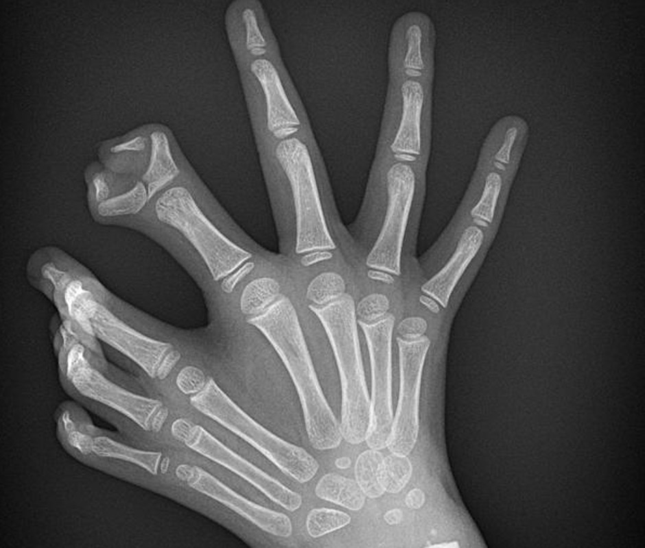 Как выглядит рука здорового человека Amazing radiology images: How sharing them is changing medicine - ABC News